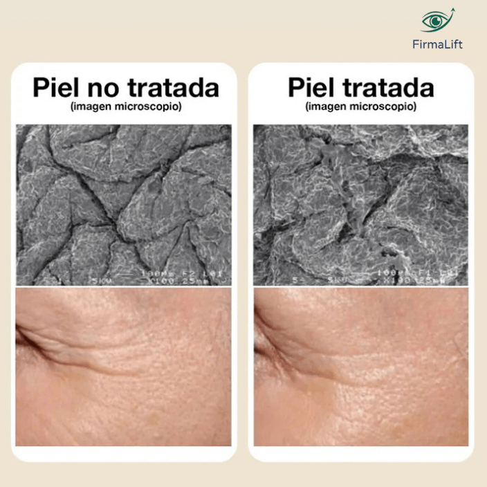 FirmaLift®️ - La Crema que Devuelve la Elasticidad y el Tono de tu Mirada