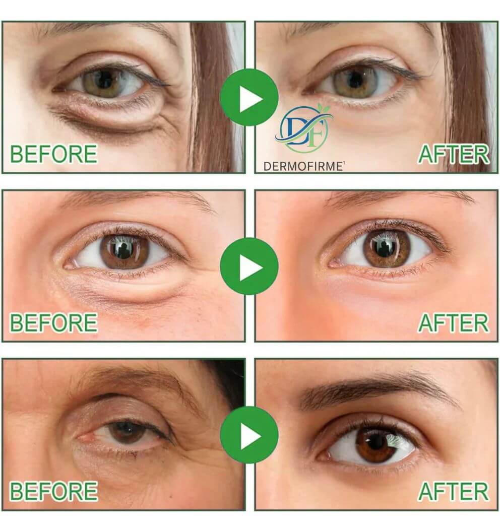DermoFirme®️ - Reduce bolsas y ojeras con colágeno puro de absorción profunda en casa