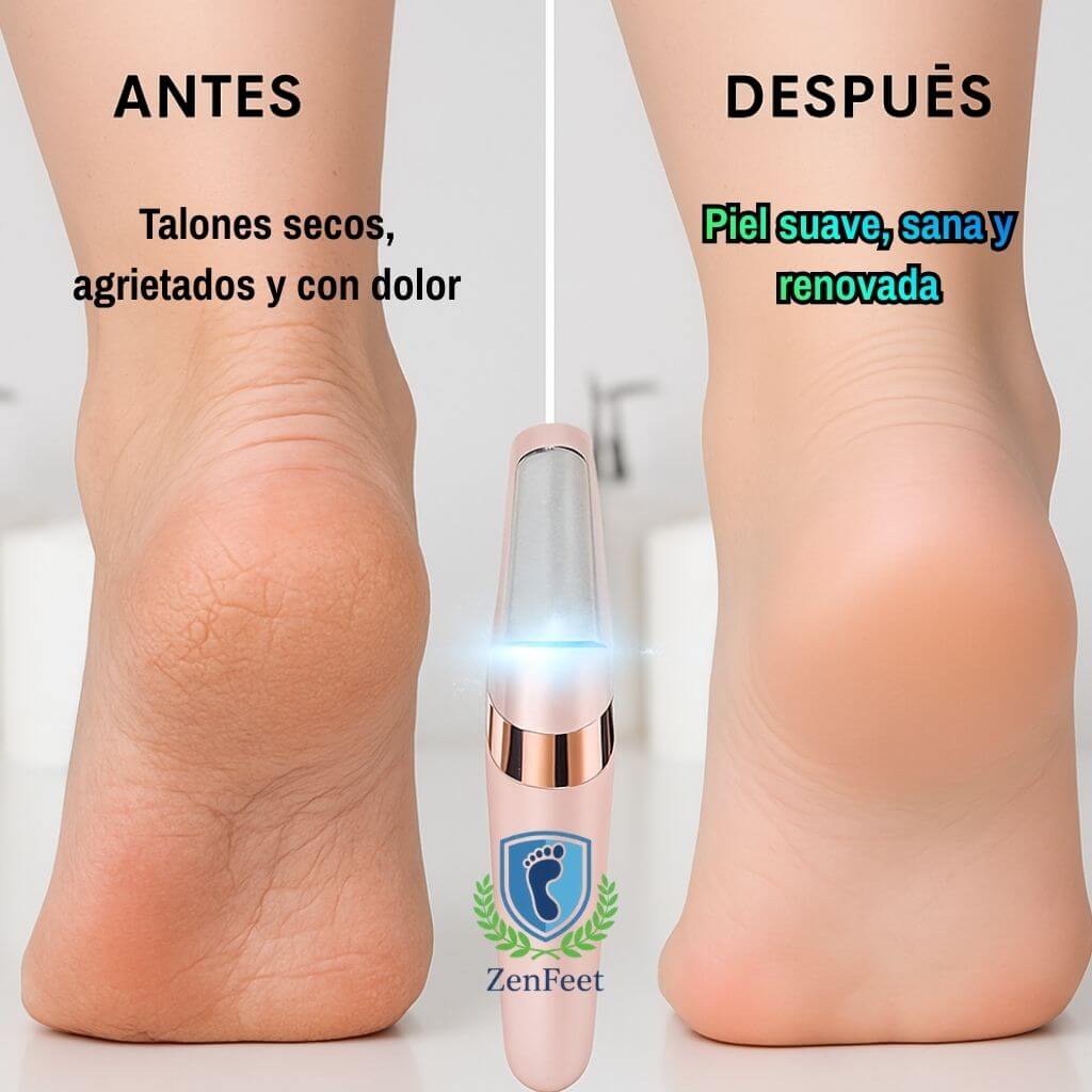 ZenFeet®️ - El Removedor de Callos que recupera la suavidad de tus pies en casa de forma segura y sin cortes.