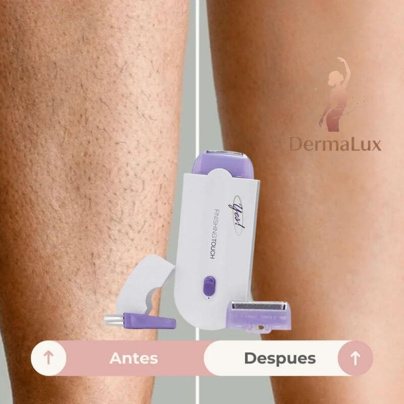 DermaLux®️– La Depiladora Láser que te da Resultados de Salón, Ahorrando Tiempo y Dinero!