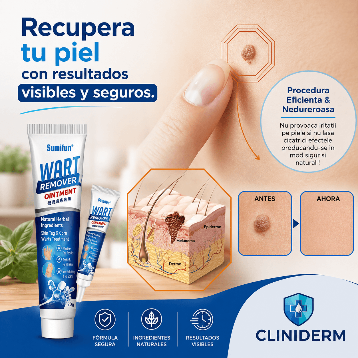 Cliniderm®: La solución definitiva y discreta para eliminar verrugas en casa.